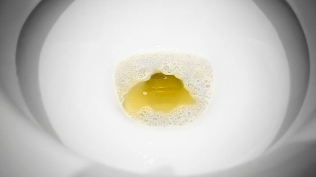 Why Is My Toilet Water Yellow