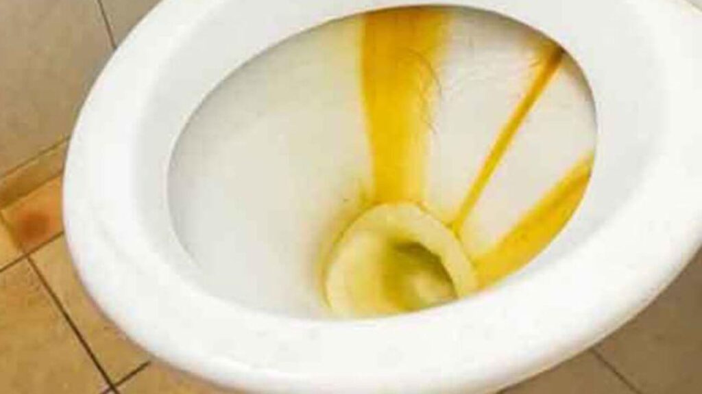 How to Remove Yellow Water Stains in Toilet